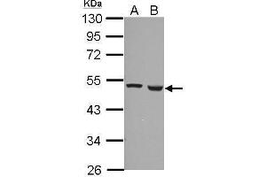 WB Image Sample (30 ug of whole cell lysate) A: A549 B: HCT116 10% SDS PAGE antibody diluted at 1:1000 (Ferredoxin Reductase antibody)