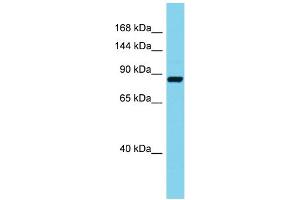 Host: Rabbit Target Name: Stim2 Sample Type: Mouse Pancreas lysates Antibody Dilution: 1.