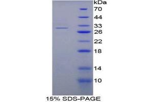 SDS-PAGE (SDS) image for Nucleoporin 88kDa (NUP88) (AA 57-296) protein (His tag) (ABIN2126167)