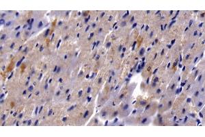 Immunohistochemistry (IHC) image for anti-Heparin-Binding EGF-Like Growth Factor (HBEGF) (AA 21-160) antibody (ABIN7433663)