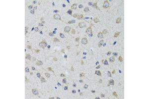 Immunohistochemistry of paraffin-embedded rat brain using HTR3A antibody (ABIN1876848) at dilution of 1:100 (40x lens).