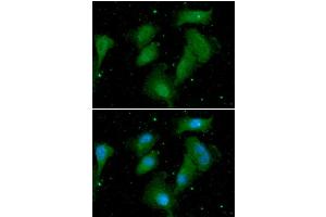 ICC/IF analysis of AKT1/3 in A549 cells. (AKT1/3 antibody)