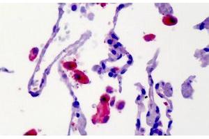 Human Lung: Formalin-Fixed, Paraffin-Embedded (FFPE) (CAMK2B antibody)