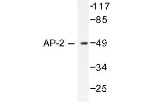 Image no. 1 for anti-Transcription Factor AP-2 alpha (Activating Enhancer Binding Protein 2 Alpha) (TFAP2A) antibody (ABIN265311) (TFAP2A antibody)