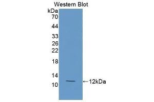 Western Blotting (WB) image for anti-Cholesteryl Ester Transfer Protein (CETP) (AA 353-443) antibody (ABIN1858370)