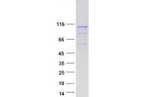 Validation with Western Blot (LRRC41 Protein (Myc-DYKDDDDK Tag))