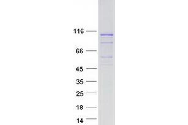 LRRC41 Protein (Myc-DYKDDDDK Tag)