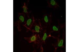 Immunofluorescence analysis of Hela cells using ESR1 mouse mAb (green). (Estrogen Receptor alpha antibody)