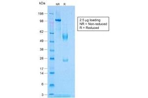 SDS-PAGE analysis of purified, BSA-free recombinant TNFa antibody (clone TNF/1500R) as confirmation of integrity and purity. (TNF alpha antibody)