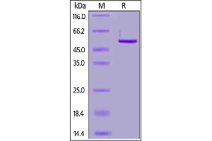 SDS-PAGE (SDS) image for SARS-CoV-2 Nucleocapsid (SARS-CoV-2 N) (AA 1-419) (Active) protein (His tag) (ABIN7013242)