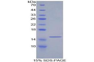 SDS-PAGE analysis of Human GDF6 Protein. (GDF6 Protein)