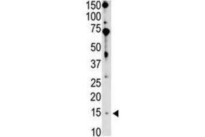 Western Blotting (WB) image for anti-BCL2-Interacting Killer (Apoptosis-Inducing) (BIK) (BH3 Domain) antibody (ABIN2997206) (BIK antibody  (BH3 Domain))