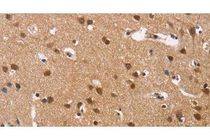 Immunohistochemistry (Paraffin-embedded Sections) (IHC (p)) image for anti-Calcium Channel, Voltage-Dependent, L Type, alpha 1D Subunit (CACNA1D) antibody (ABIN7243073)