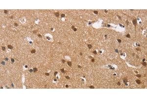 Immunohistochemistry of paraffin-embedded Human brain tissue using Cav1. (CACNA1D antibody)