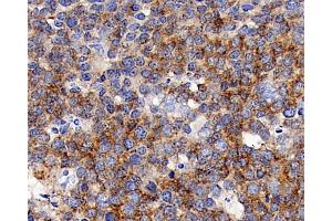 Immunohistochemistry analysis of paraffin-embedded human tonsil using CD192 Polyclonal Antibody at dilution of 1:300. (CCR2 antibody)