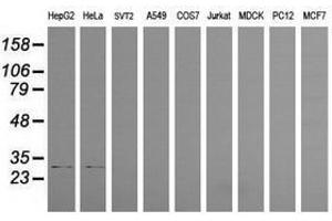 Image no. 2 for anti-Proteasome (Prosome, Macropain) Inhibitor Subunit 1 (PI31) (PSMF1) antibody (ABIN1500490) (PSMF1 antibody)