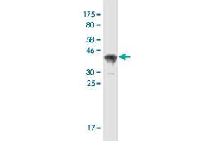 Western Blot detection against Immunogen (38. (SPPL2A antibody  (AA 31-129))