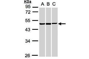 WB Image Sample(30 ug whole cell lysate) A:A431, B:HeLa S3, C:MOLT4 , 10% SDS PAGE antibody diluted at 1:1000 (BZW2 antibody)