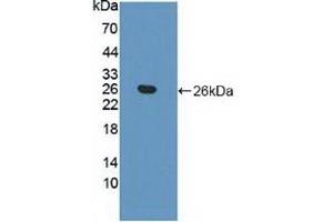 Detection of Recombinant APOB, Human using Polyclonal Antibody to Apolipoprotein B (APOB) (APOB antibody  (AA 3365-3548))