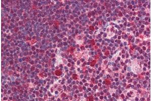 Human Thymus (formalin-fixed, paraffin-embedded) stained with SNW1 antibody ABIN214517 at 5 ug/ml followed by biotinylated goat anti-rabbit IgG secondary antibody ABIN481713, alkaline phosphatase-streptavidin and chromogen. (SNW1 antibody  (C-Term))