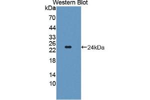 Detection of Recombinant TWSG1, Human using Polyclonal Antibody to Twisted Gastrulation Protein Homolog 1 (TWSG1) (TWSG1 antibody  (AA 26-223))