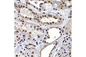 Immunohistochemistry of paraffin-embedded human kidney using H2AFY antibody at dilution of 1:100 (x400 lens). (H2AFY antibody)