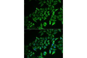 Immunofluorescence analysis of A549 cell using INPP5J antibody. (INPP5J antibody)