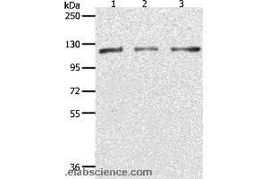 Western blot analysis of Hela, K562 and Jurkat cell, using PARP1 Polyclonal Antibody at dilution of 1:350 (PARP1 antibody)