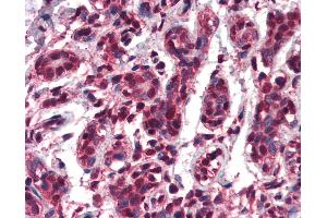 Anti-TCF3 antibody IHC of human breast. (TCF3 antibody  (AA 522-535))