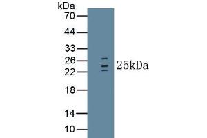 Detection of Recombinant IL1RA, Human using Monoclonal Antibody to Interleukin 1 Receptor Antagonist (IL1RA) (IL1RN antibody  (AA 26-177))
