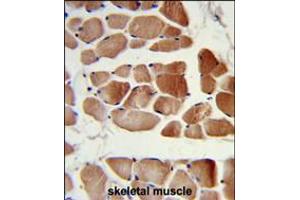 Formalin-fixed and paraffin-embedded human skeletal muscle reacted with RUVBL1 Antibody, which was peroxidase-conjugated to the secondary antibody, followed by DAB staining. (RUVBL1 antibody)