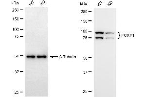 Western blotting analysis using FOXP1 antibody (ABIN7798652). (Recombinant FOXP1 antibody)