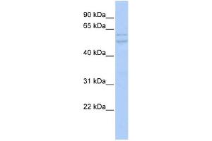 WB Suggested Anti-UXS1 Antibody Titration:  0. (UXS1 antibody  (Middle Region))