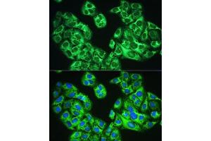 Immunofluorescence analysis of U2OS cells using YTHDF1 Rabbit pAb  at dilution of 1:100. (YTHDF1 antibody)