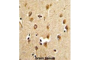 Immunohistochemistry (IHC) image for anti-Abl-Interactor 1 (ABI1) antibody (ABIN3003792) (ABI1 antibody)