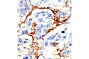 Image no. 2 for anti-DOK2 (DOK2) (C-Term) antibody (ABIN359960) (DOK2 antibody  (C-Term))