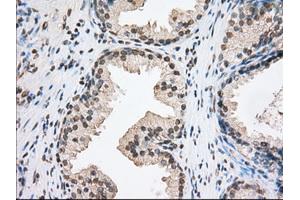 Immunohistochemical staining of paraffin-embedded Human Kidney tissue using anti-TACC3 mouse monoclonal antibody.