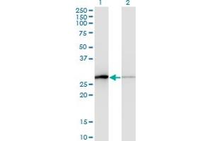 Western Blot analysis of TCEAL1 expression in transfected 293T cell line by TCEAL1 monoclonal antibody (M01), clone 3B9. (TCEAL1 antibody  (AA 1-159))