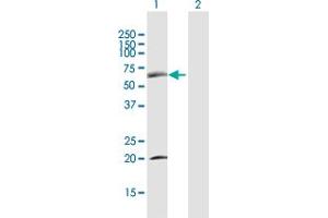 Western Blot analysis of SDPR expression in transfected 293T cell line by SDPR MaxPab polyclonal antibody.
