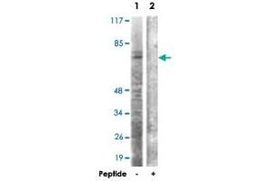 Western blot analysis of extracts from HT-29 cells, using CDC6 polyclonal antibody .