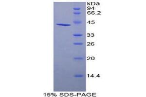 SDS-PAGE analysis of Human uPAR Protein. (PLAUR Protein)