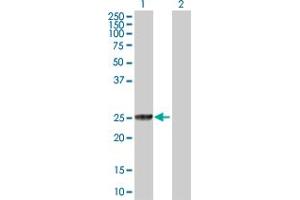 Western Blot analysis of GSTT2 expression in transfected 293T cell line by GSTT2 MaxPab polyclonal antibody.