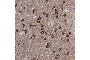 Immunohistochemical staining of human lateral ventricle with AGPAT9 polyclonal antibody  shows strong cytoplasmic positivity in neuronal cells. (AGPAT9 antibody)