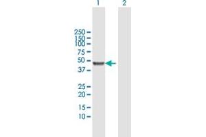 Western Blot analysis of KRT20 expression in transfected 293T cell line by KRT20 MaxPab polyclonal antibody. (KRT20 antibody  (AA 1-424))