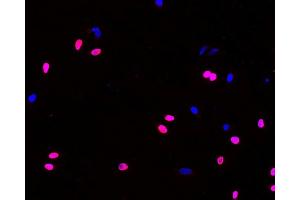 Immunofluorescence analysis of Hela cells(treated with 0. (BrdU antibody)