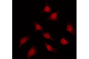 ABIN6267296 staining HeLa by IF/ICC. (HSP27 antibody  (pSer82))