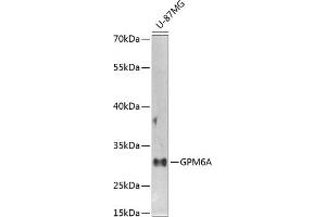 Western blot analysis of extracts of U-87MG cells, using GPM6A antibody (ABIN6134764, ABIN6141338, ABIN6141340 and ABIN6224880) at 1:1000 dilution. (GPM6A antibody  (AA 1-100))