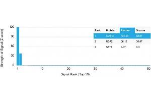 Analysis of Protein Array containing more than 19,000 full-length human proteins using CD11c Mouse Monoclonal Antibody (ITGAX/1242). (CD11c antibody  (AA 637-827))