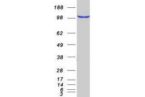 Validation with Western Blot