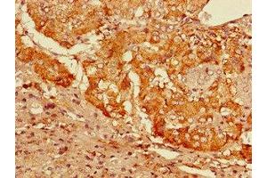 Immunohistochemistry of paraffin-embedded human adrenal gland tissue using ABIN7153725 at dilution of 1:100 (GFRA3 antibody  (AA 32-236))
